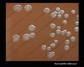 haemophilus influenzae